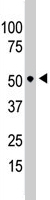 PAB4652 - BCKDK