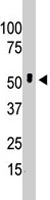 PAB4652 - BCKDK