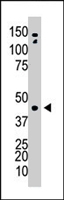 PAB4653 - Adenosine kinase