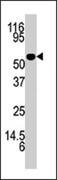 PAB4654 - Adenosine kinase