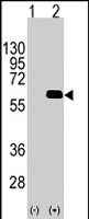 PAB4656 - AKT2 / PKB beta
