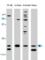 PAB4677 - DJ-1 beta