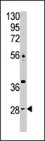 PAB4679 - Carbonic anhydrase 9
