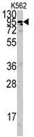 PAB4687 - ACE2