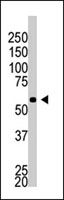 PAB4694 - BACE2