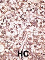 PAB4698 - ABCB4 / MDR3