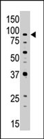 PAB4700 - ABCB7