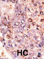 PAB4700 - ABCB7