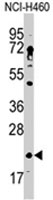 PAB4702 - HAND2 / DHAND