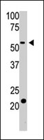 PAB4706 - BACE2