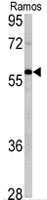 PAB4709 - IAP3 / BIRC4