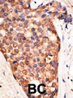 PAB4709 - IAP3 / BIRC4