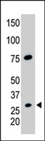 PAB4713 - Cdx1