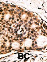 PAB4713 - Cdx1