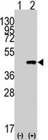 PAB4714 - Cdx2