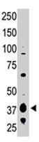 PAB4719 - EDG2 / LPAR1
