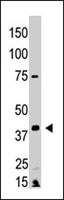 PAB4721 - EDG4 / LPAR2