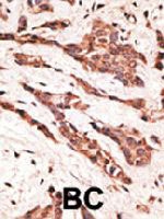 PAB4721 - EDG4 / LPAR2