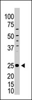 PAB4726 - CD278 / ICOS