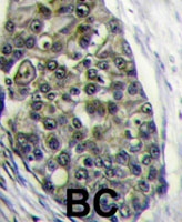 PAB4736 - LRP6