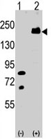 PAB4736 - LRP6
