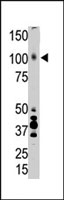 PAB4740 - APOER2 / LRP8