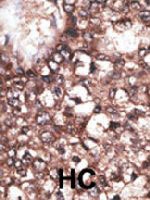 PAB4740 - APOER2 / LRP8