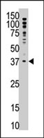 PAB4759 - MAGE-F1