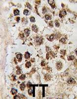 PAB4767 - MLLT10 / AF10