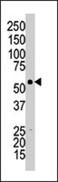 PAB4771 - MLLT3 / AF9