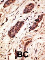 PAB4779 - MMP-10