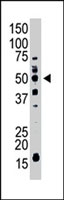 PAB4780 - MMP-11