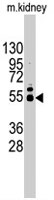 PAB4781 - MMP-12
