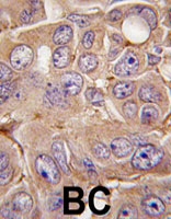 PAB4781 - MMP-12