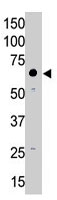 PAB4782 - MMP-14 / MT1-MMP