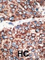 PAB4782 - MMP-14 / MT1-MMP