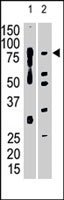 PAB4783 - MMP-15