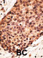 PAB4784 - MMP-16