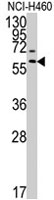 PAB4785 - MMP-17