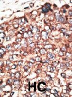 PAB4785 - MMP-17