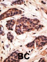 PAB4786 - MMP-19