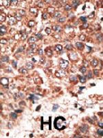 PAB4787 - MMP-20