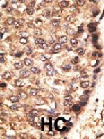 PAB4789 - MMP-24