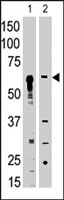PAB4790 - MMP-25