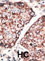 PAB4795 - MMP-3