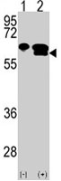 PAB4795 - MMP-3