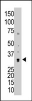 PAB4796 - MMP-7
