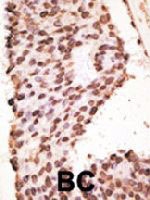 PAB4796 - MMP-7