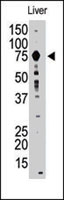 PAB4798 - MMP-9