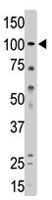 PAB4800 - Major Vault Protein